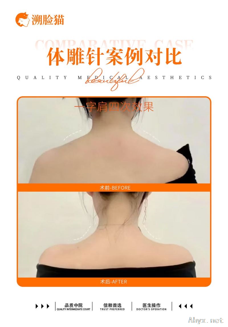 招美容师13点到21点，8小时